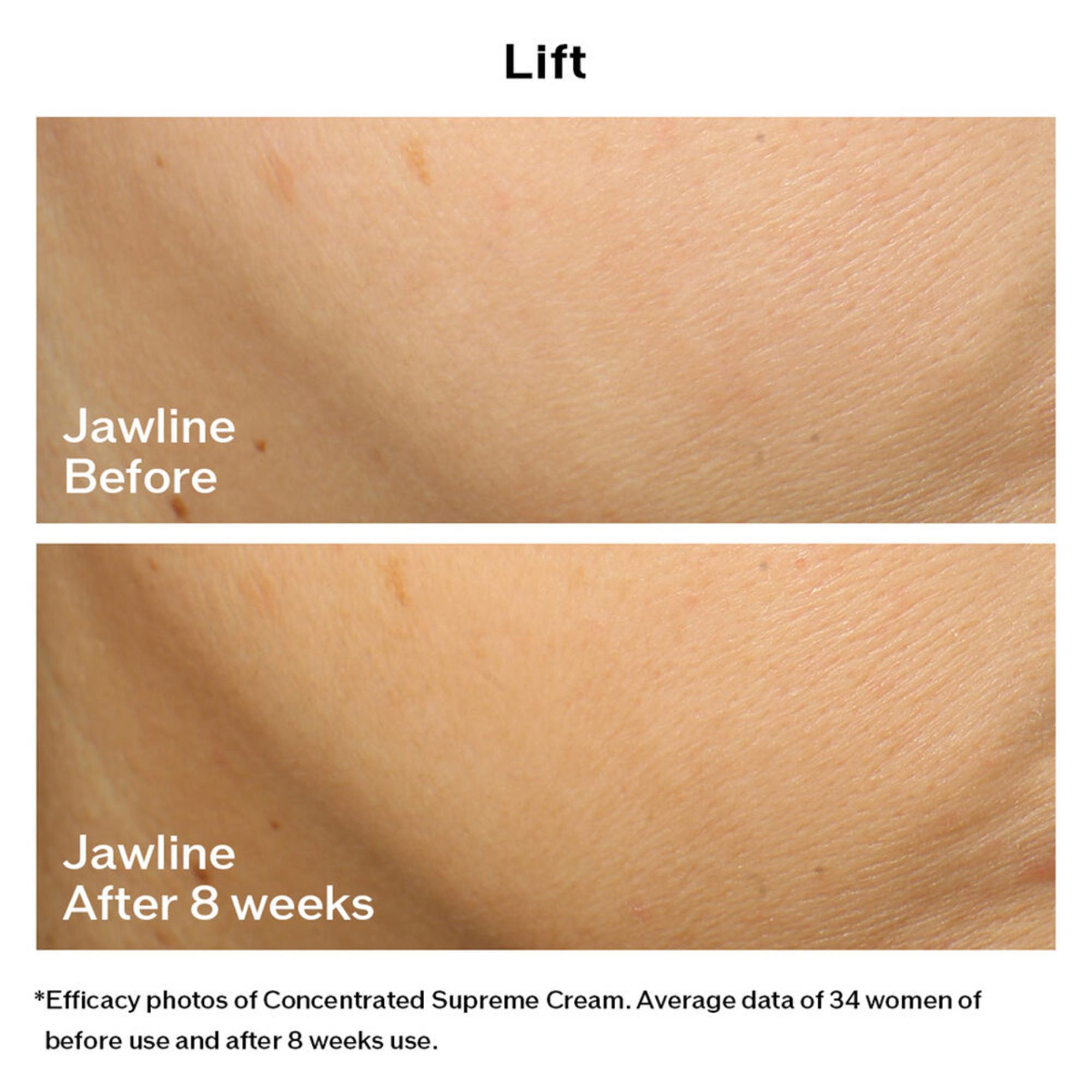 Shiseido Vital Perfection Concentrated Supreme Cream 50ml